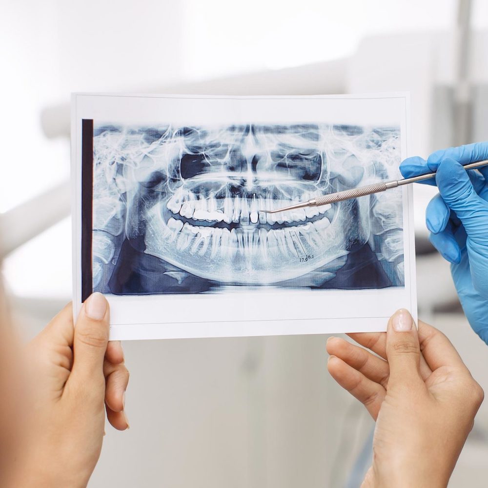 Dentist showing X-ray image to patient